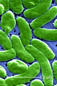 A scanning electron micrograph of Vibrio vulnificus bacteria. Magnified 13,184X. Image courtesy Centers for Disease Control and Prevention.