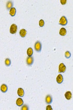 Individual cells of the toxic algae <em>Chattonella subsalsa</em>.
