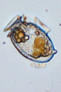 The armored dinoflagellate Dinophysis.