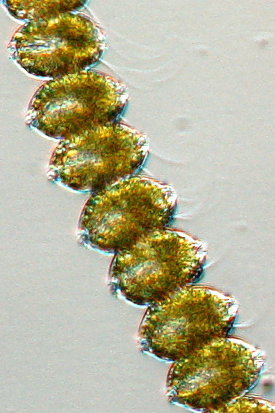 A chain of the dinoflagellate Alexandrium monilatum. A 30-cell chain is about 1 millimeter long. The longest chains are just visible to the naked eye. Photomicrograph by Bill Jones.