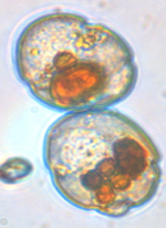 A further close-up of a pair of cells of the bloom-forming dinoflagellate Cochlodinium polykrikoides. Photo courtesy of Dr. Kim Reece/VIMS.