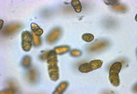 Microphotograph of cells of the bloom-forming dinoflagellate Cochlodinium polykrikoides. Photo courtesy of Dr. Kim Reece.