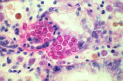 A histological image of Haplosporidium nelsoni (MSX). The pink refractory bodies are MSX spores in oyster tissues. Image by Dr. Gene Burreson.