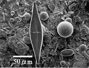 An assemblage of benthic diatoms. Photo: Yoichi Kogure, http://cse.fra.affrc.go.jp/seastar/food-chain.html