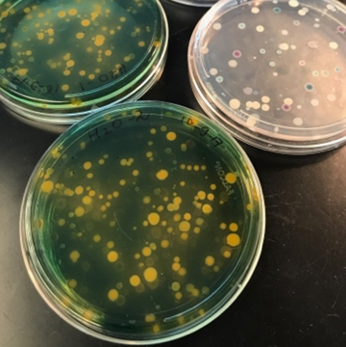 Vibrio bacteria on a plate.