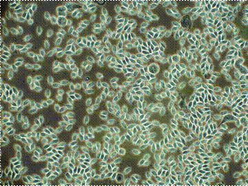 Dinospores of hematodinium