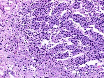 Sheets of parasite cells