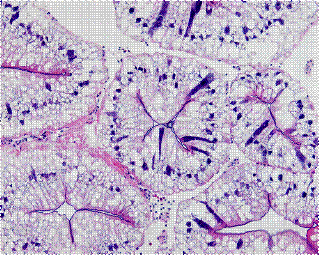 Hepatopancreas uninfected
