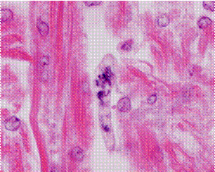 Filamentous trophont